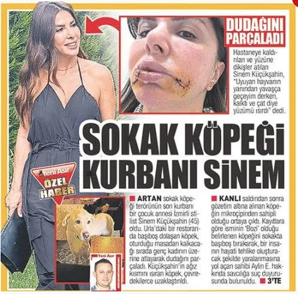 Stilist Sinem dehşeti yaşadı, sokak köpeği dudağını parçaladı! Meğer sahipliymiş gibi çip taktırıp... - Resim: 1