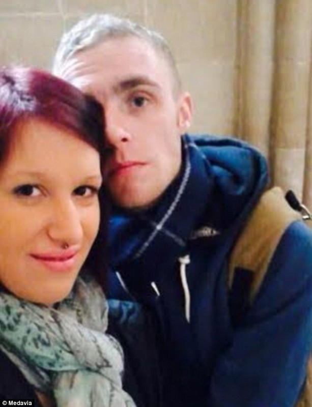 Sevgilisini yemeye çalıştı 21 kez ısırdı... - Resim: 2