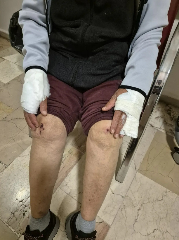 Tunceli'yi ayağa kaldıran iddia: Avukat Alişer Ölmez öz teyzesini darp etti - Resim: 3