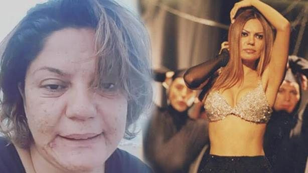 Ünlü şarkıcı İzel tam 15 kilo verdi yeni halini gören şaştı kaldı - Resim: 1