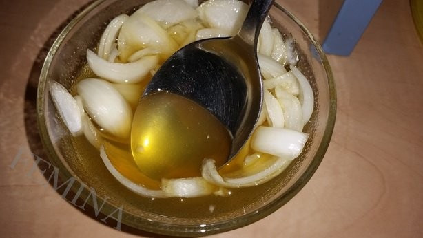 Soğanı alıp kulağınıza sokun olanlara inanamayacaksınız! - Resim: 2