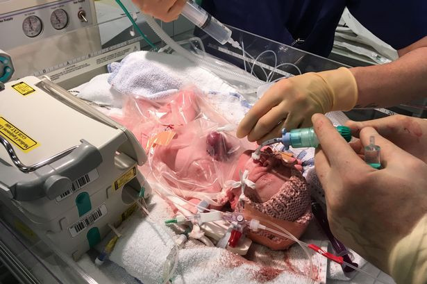 Doktorlar aldır dedi dinlemedi bu halde doğdu - Resim: 3