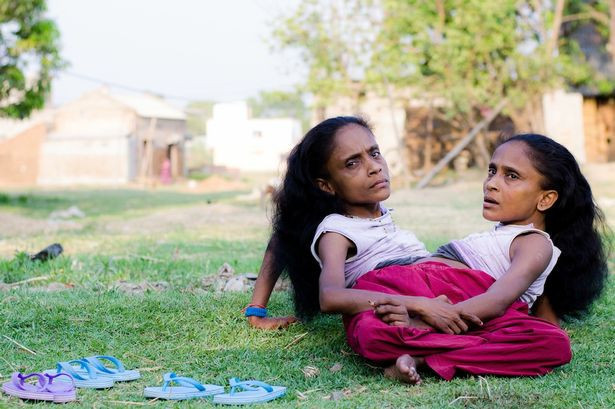 Bu halde doğdular bir de aynı adama aşık olunca... - Resim: 4