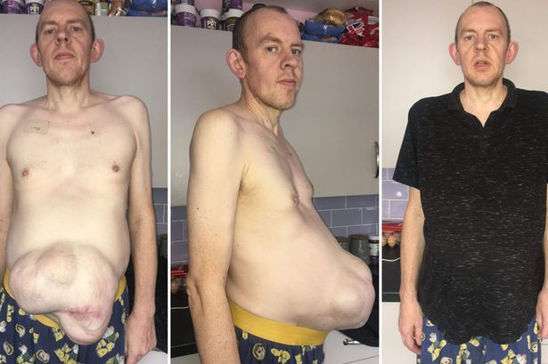 5 yılda bu hale geldi! Hamile gibi görünüyor - Resim: 4