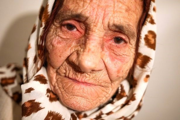 İnsanları yalayarak iyileştiriyor mucize dil inanılmaz... - Resim: 4