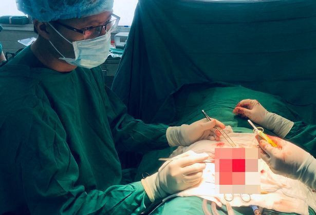 Cinsel organını makasla kesti kıskanç eş uyurken kocasına dehşeti yaşattı! - Resim: 2