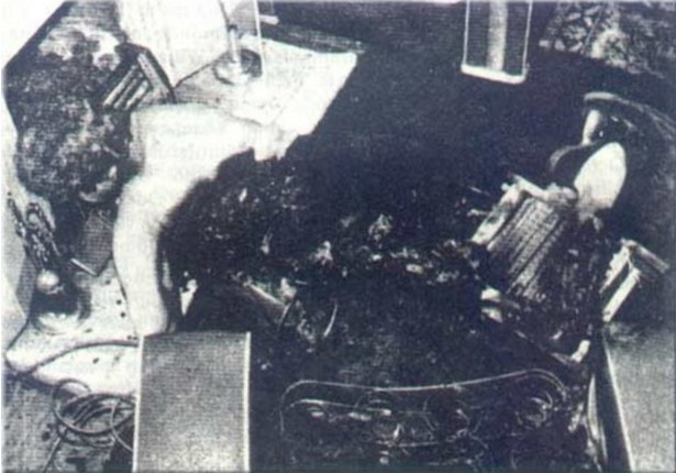 Öyle bir rahatsızlığı var ki! Tedavisi bulunamıyor  - Resim: 2