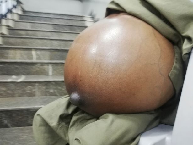 Korkunç olay! Sık sık karnı ağrıyordu 1 yılda bu hale geldi - Resim: 4