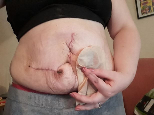 Dışkısını kusmaya başlayınca...Akıllara durgunluk veren olay! - Resim: 2