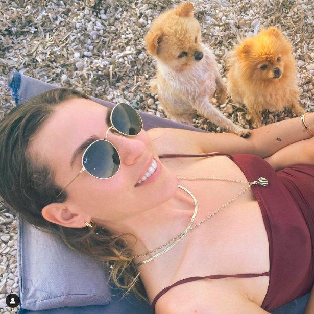 Sinem Kobal'dan karnı burnunda ilk poz geldi son haline yorum yağdı - Resim: 3