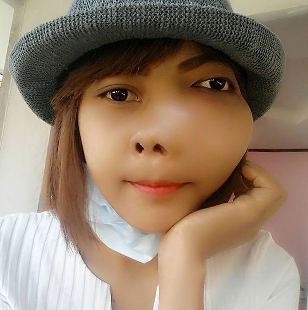 Diş ağrısı için gitti tümör çıktı tanınmaz halde... - Resim: 3