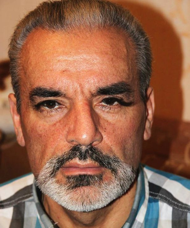 Dünyanın en uzun kirpikli insanı! - Resim: 1