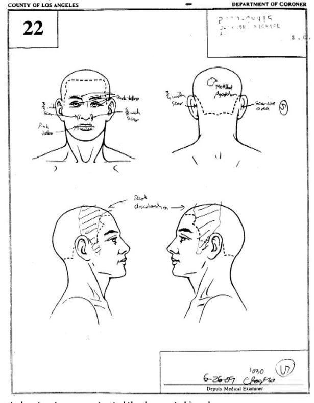 Michael Jackson'ın gizlenen otopsi raporu ortaya çıktı! Aslında kelmiş - Resim: 4