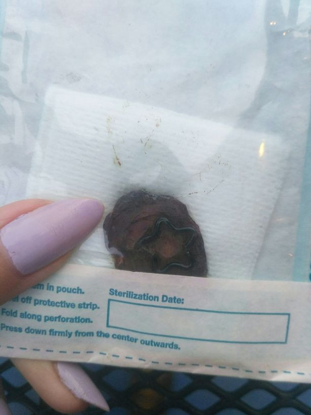 Göbek deliğini aldırıp sevgilisine hediye etti! Yaptığı bununla da sınırlı değil... - Resim: 4