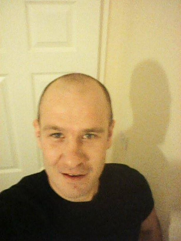 Çocuğu bile yaklaşamadı genç kadın korkunç hale geldi: Cehennemi yaşadım - Resim: 2