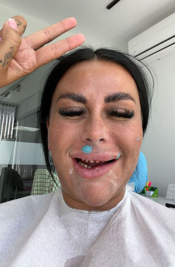 Antalya'ya diş estetiği yaptırmaya geldiler hayatları karardı! Ağızlarına koyamıyorlar... - Resim: 4