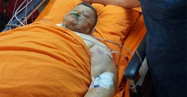 Yeşilçam'ın Şişko Nuri'si hastaneye kaldırıldı son durum ne? - Resim: 2