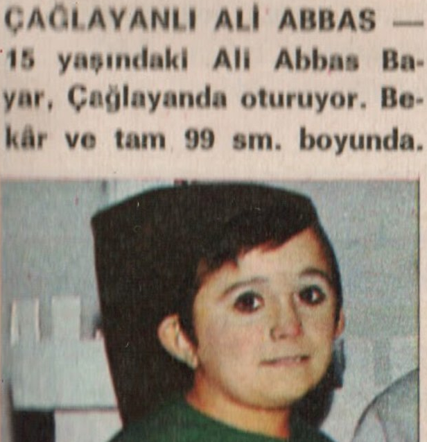 Pamuk Prenses'in 7 Cücelerinden olan 'Uykucu' şimdilerde tanınmaz halde - Resim: 2