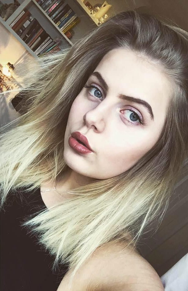 Kilo aldığını düşünüyordu ama bakın ne çıktı! - Resim: 2