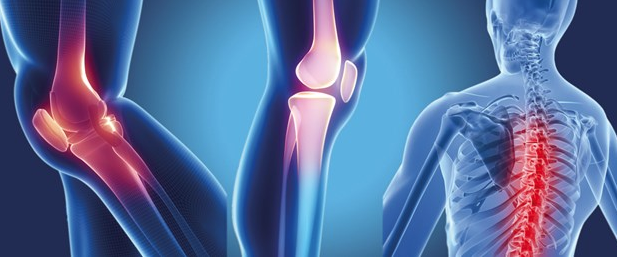 Türkiye'de günden güne artan hastalık: Kemik erimesi nedir? - Resim: 1