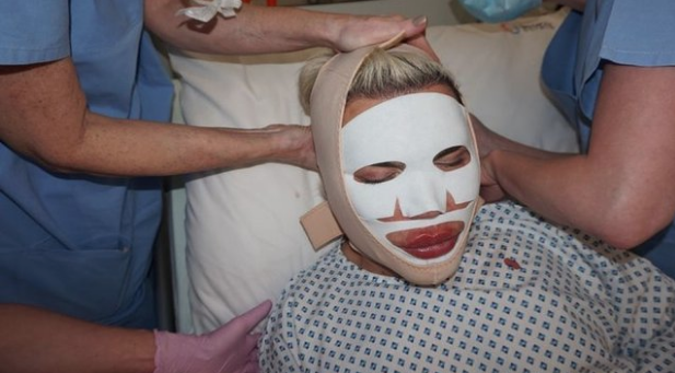 60 kez operasyon geçirdi doktorları dinlemedi! Son hali olay - Resim: 1