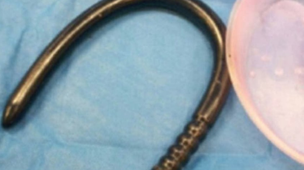 Akıllara durgunluk veren olay sarhoş adamın anüsünden bu çıktı - Resim: 2