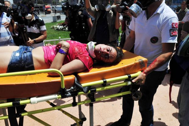 Turistin kafasını kırdılar... - Resim: 1