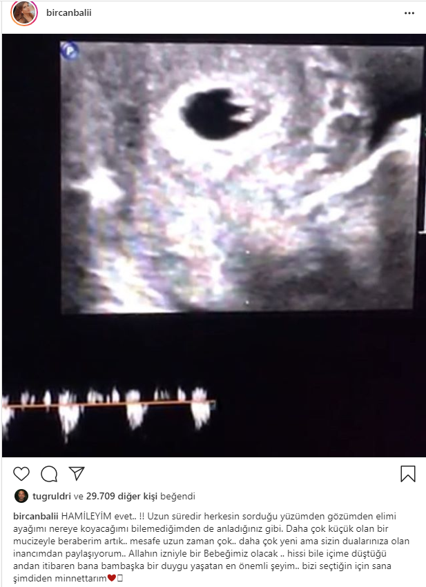 Bircan Bali müjdeyi verdi hamile olduğunu açıkladı! Avukat Ömer Gezen ile evli - Resim: 2