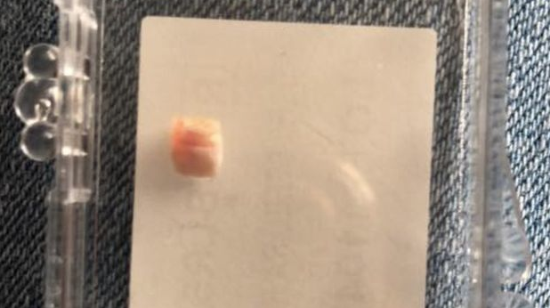 Sonunda bu da oldu! 12 günlük bebek diş çektirdi - Resim: 3