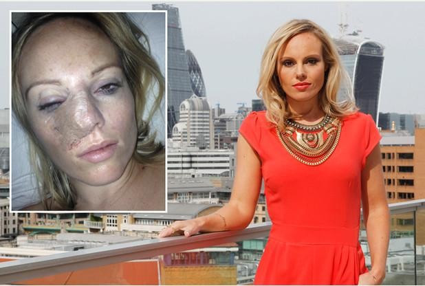 Yüzündekini sivilce sandı tümör çıktı - Resim: 1