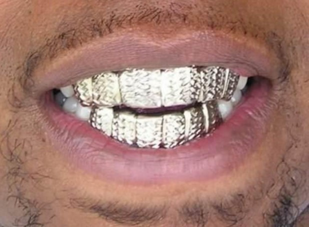 En değerli maddeler! Gramı trilyon dolar...  - Resim: 4