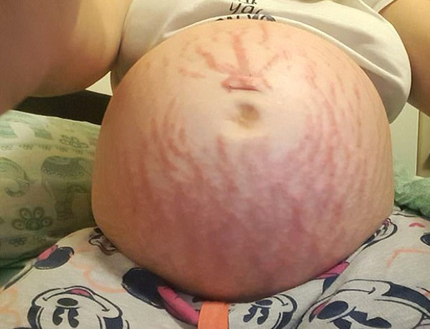 Doğmamış bebeği onu öldürüyordu inanılmaz olay - Resim: 3