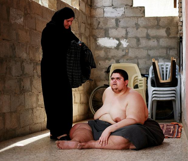 400 kilo olan genç yardım bekliyor - Resim: 4