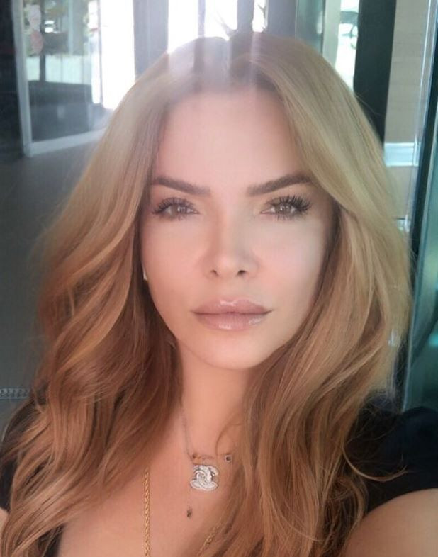 TV8 Müge ve Gülşen'le 2. Sayfa'da Pınar Eliçe'den kanser itirafı: 60 dikişim var! - Resim: 3