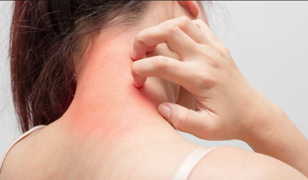 Uzmanından alerjisi olanlara önemli pencere uyarısı! - Resim: 0