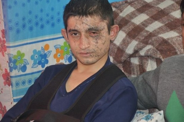 Kayseri saldırısından kurtulan asker yaşadıklarını anlattı - Resim: 3