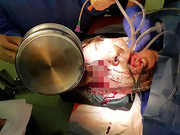 Mutfakta yere düştü gözüne tencere saplandı akıllara zarar olay! - Resim: 3