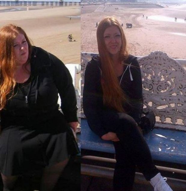 Banyoya sığamıyordu tam 115 kilo verdi sonuç müthiş - Resim: 3