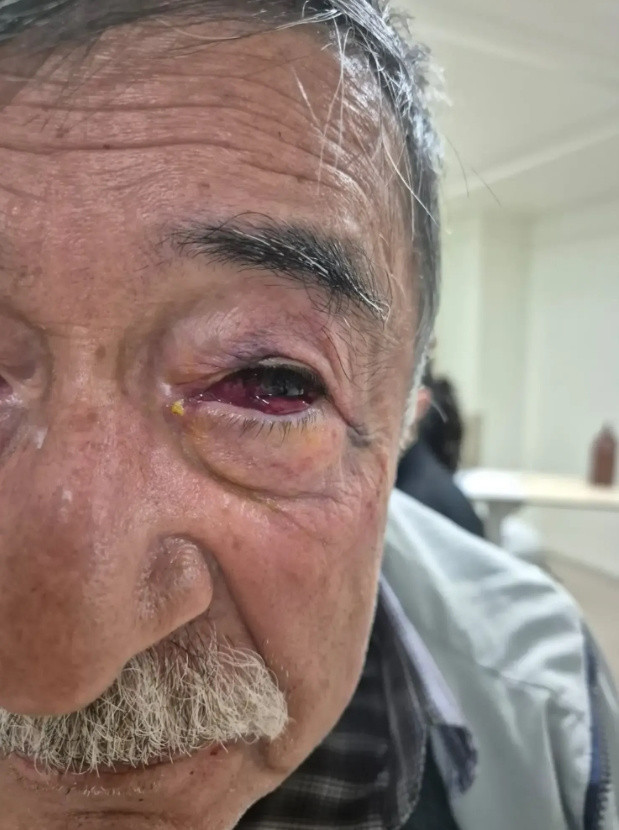 Tunceli'yi ayağa kaldıran iddia: Avukat Alişer Ölmez öz teyzesini darp etti - Resim: 1