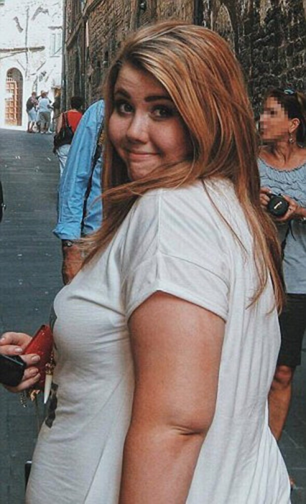 Eskiden obezdi şimdi en popüler mankenlerden biri - Resim: 3