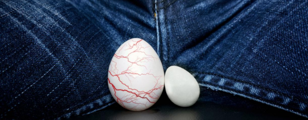 Varikosel hastalığı nedir evlenmeden önce kesinlikle tedavi olun - Resim: 0