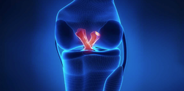 Ön çapraz bağlar kopunca ne olur? Tedavisi nasıl yapılır - Resim: 0