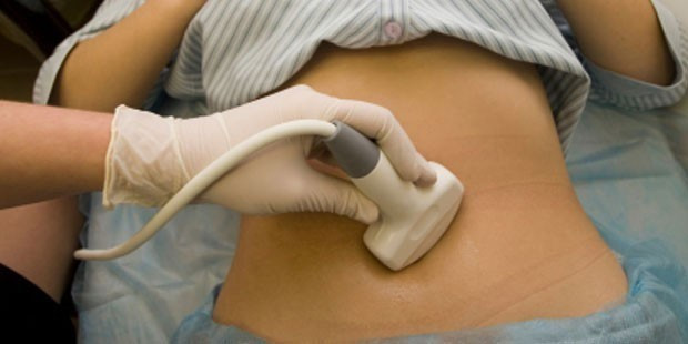 Yumurtalıklarından beyin ve saç çıktı inanılmaz olay! - Resim: 1