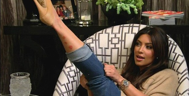 Kim Kardashian yüzünü herkesten saklıyor nedenine bakın - Resim: 4