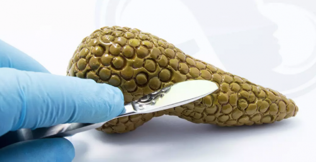 Pankreas ve karaciğer kanserlerinde çığır açan yeni tedavi yöntemi - Resim: 0