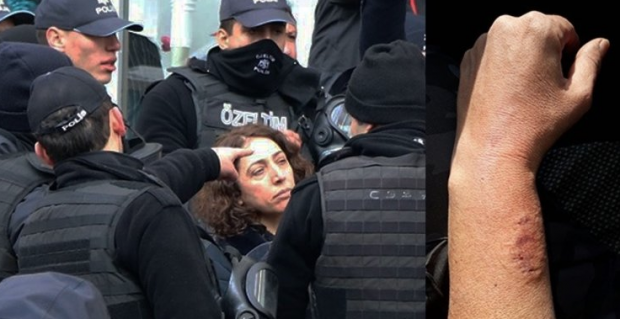 Kadın polis memurunu ısıran HDP'li vekil hakkında flaş gelişme - Resim: 0