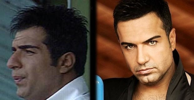 Filiz Akın'ın estetiksiz haline bakın çok şaşıracaksınız! - Resim: 2