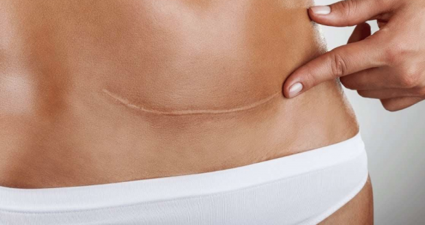 Yara izleri tamamen yok edilebilir mi uzmanlar kesin bir dille uyardı - Resim: 0