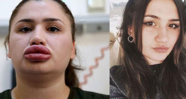 Dudakları dünya tıp literatürüne girebilir - Resim: 3