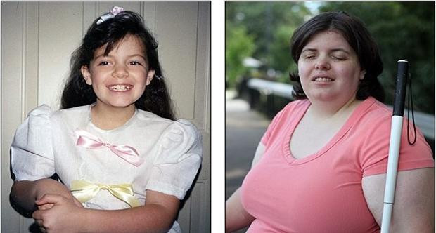 Kendi isteği ile kör oldu - Resim: 3